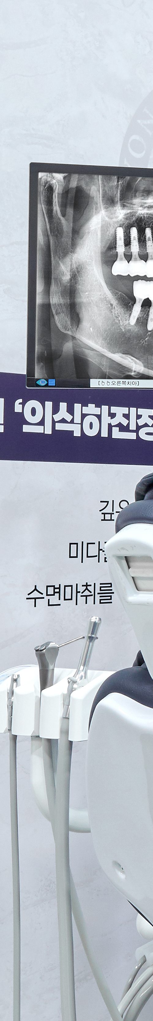 염창역치과 임플란트치료 적절한 시술 방법을 통해 관련 이미지 38