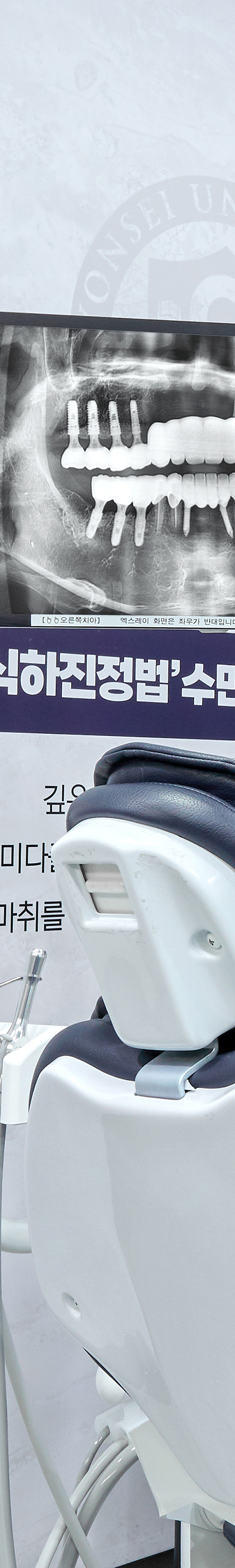 신촌임플란트 치아상실 환자에게 맞는 치료를 관련 이미지 29