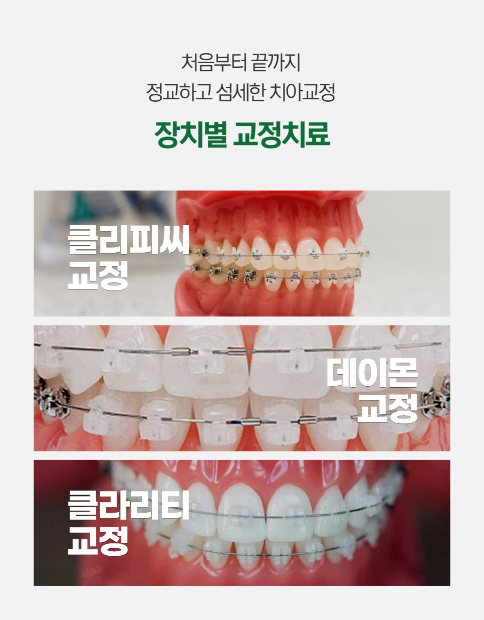 신대방역치과 인비절라인 무엇을 주의해야 관련 이미지 9