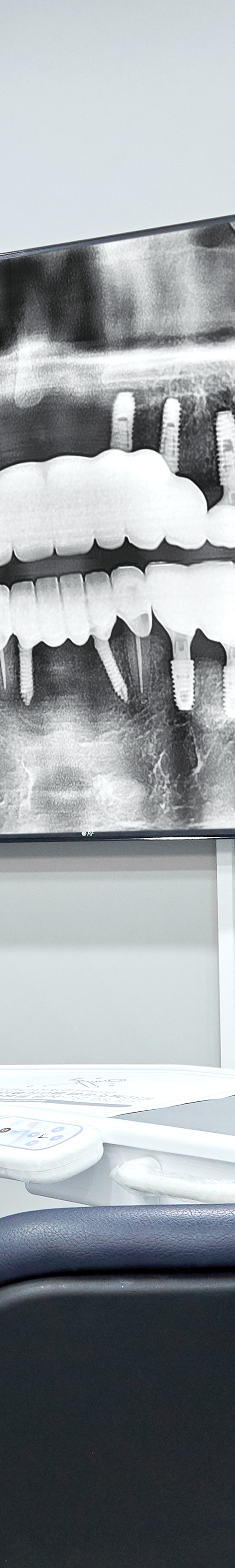 Dangsan Dental Clinic Implant Placement for Restoring Tooth Function image 24