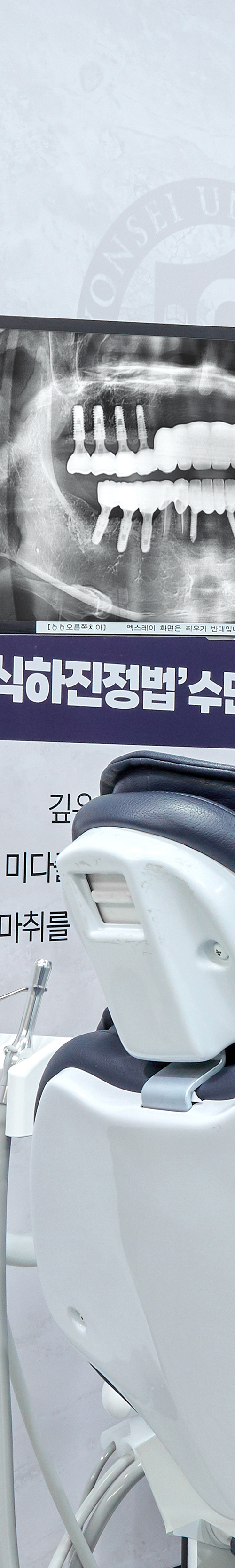 Dangsan Station Dental Clinic Sleep Implant Using Conscious Sedation image 25