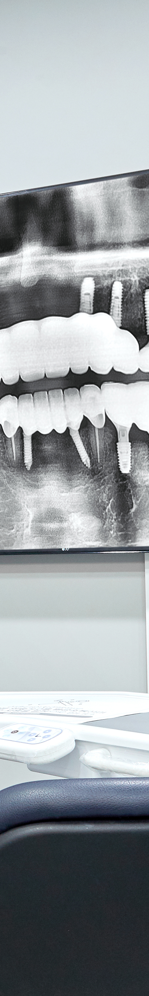 Dangsan Dental Clinic Implant Treatment in a Comfortable State image 40