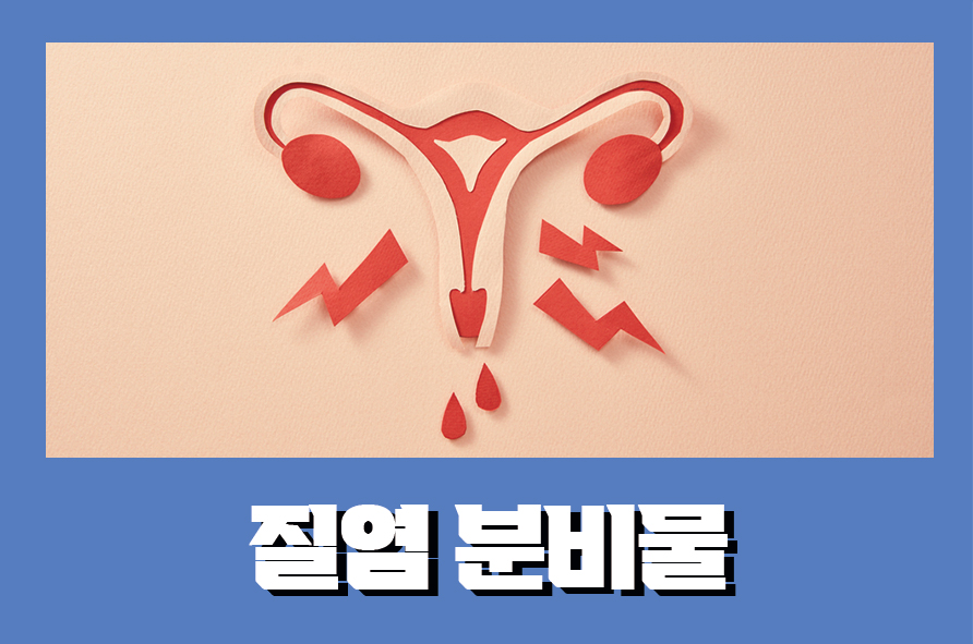 질염분비물 상태에 따른 증상별 궁금증 해결하자 관련 이미지 1