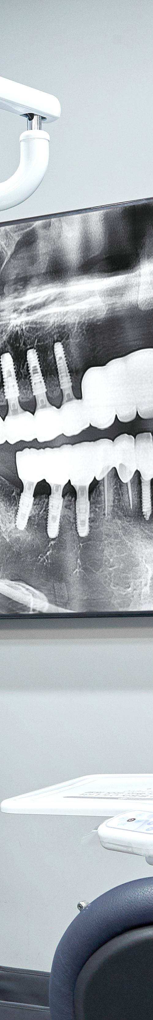 Dangsan Station Dental Clinic: Comfortable Sleep Implant Using Conscious Sedation image 24