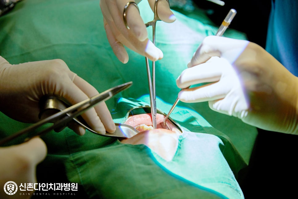 Mullae Station Dental Clinic — Sleep Implant Using Conscious Sedation image 7