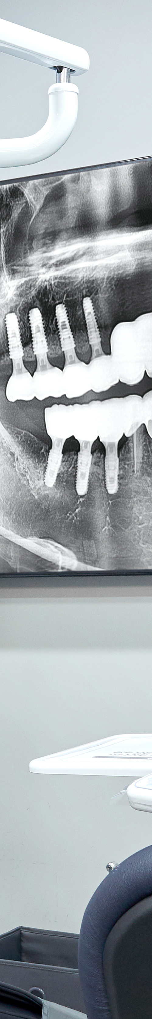 Hapjeong Station Dental Clinic Implant Treatment Through an Appropriate Treatment Plan image 43