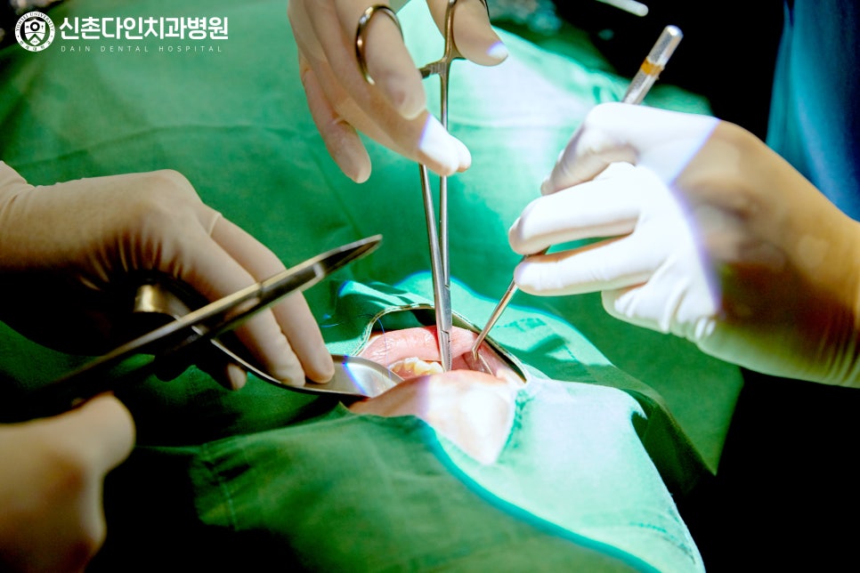 신길동치과추천 치과공포증 가수면 상태로 걱정을 덜고 관련 이미지 9