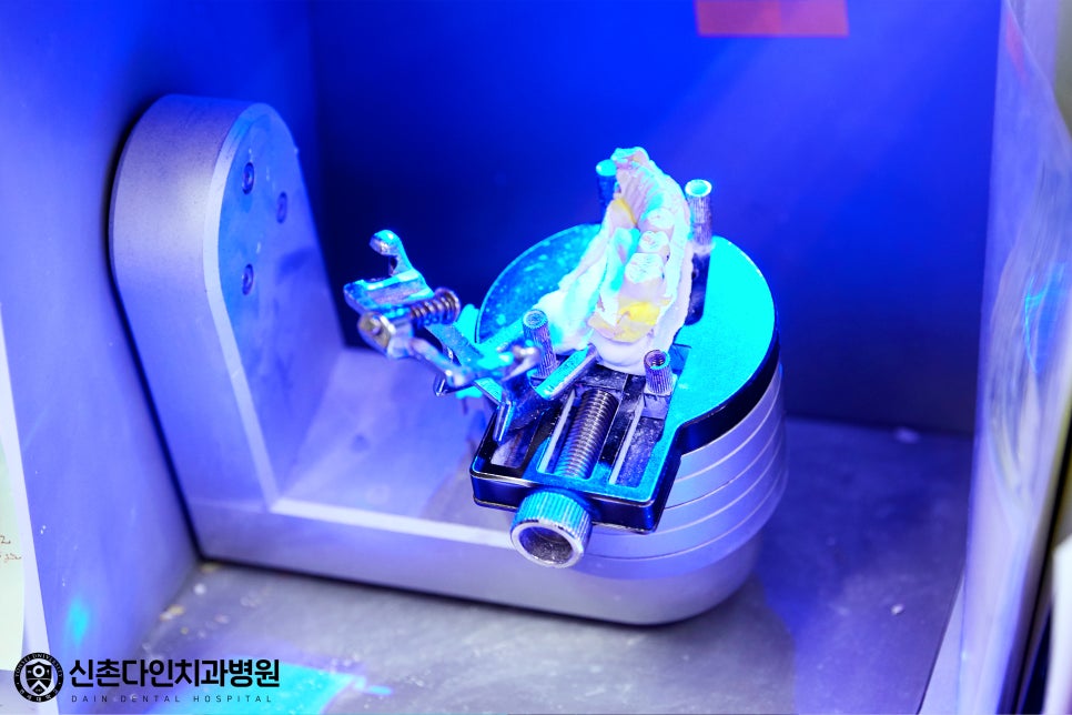 성산동치과 임플란트치료 안정성을 더한 시술을 관련 이미지 6