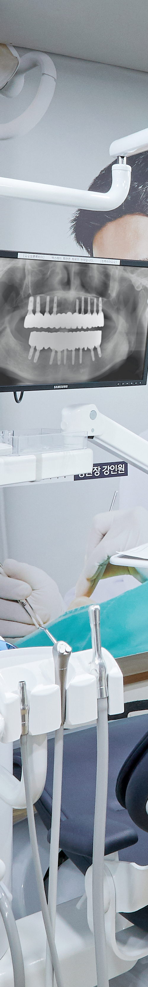영등포구청역치과 치아상실 심적 부담을 낮추고 관련 이미지 28