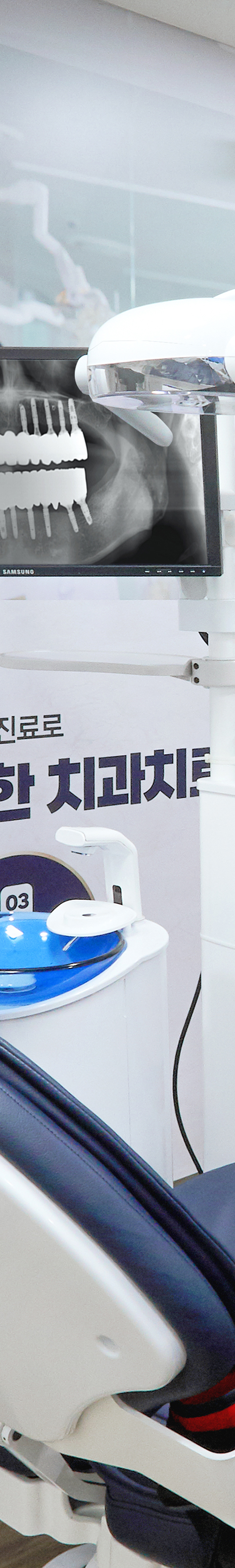 Daesang-dong Dental Clinic Implant Placement: Treatment Through a Careful Process image 37