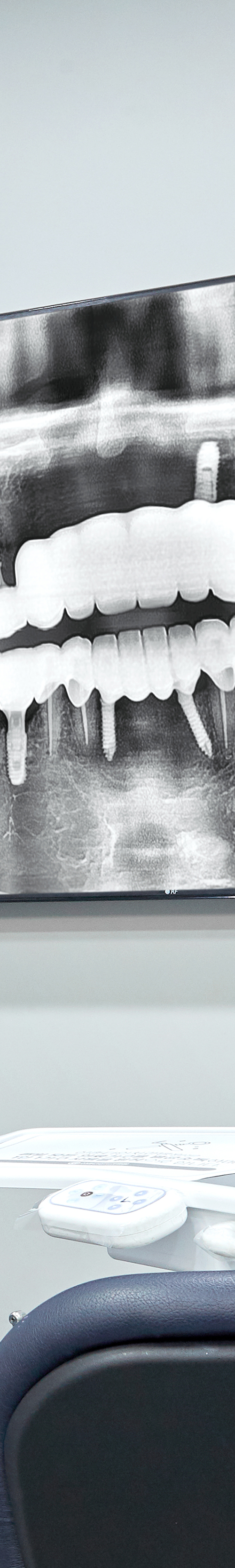 Yangpyeong Station Dental Clinic Implant Care with a Systematic Process image 24
