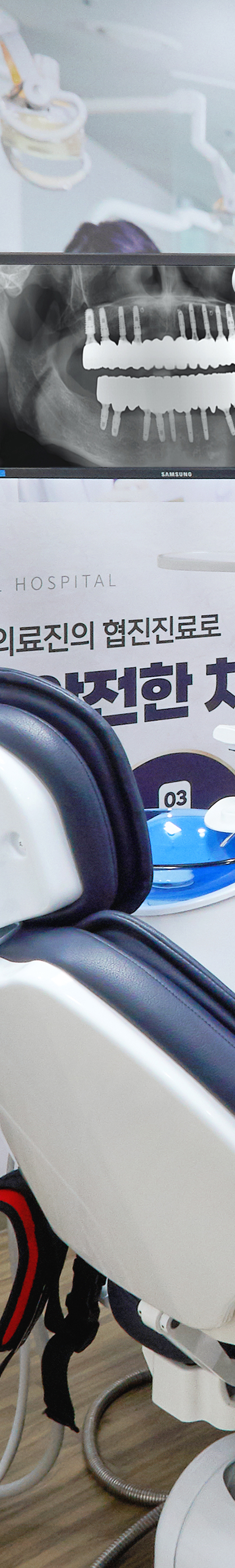 망원동치과 임플란트시술 개인의 상태를 고려하여 관련 이미지 29