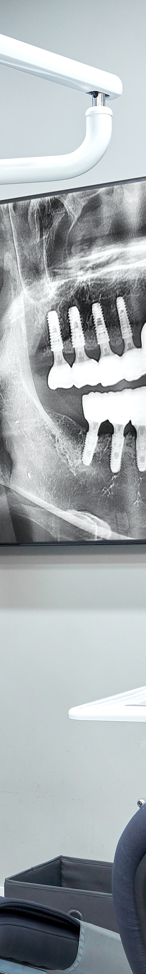 Shinchon Dental Implant Procedure Through an Individualized Plan image 33