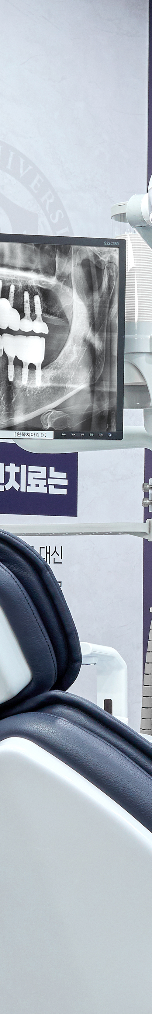 Yangpyeong Station Dental Clinic Implant Care with a Systematic Process image 20