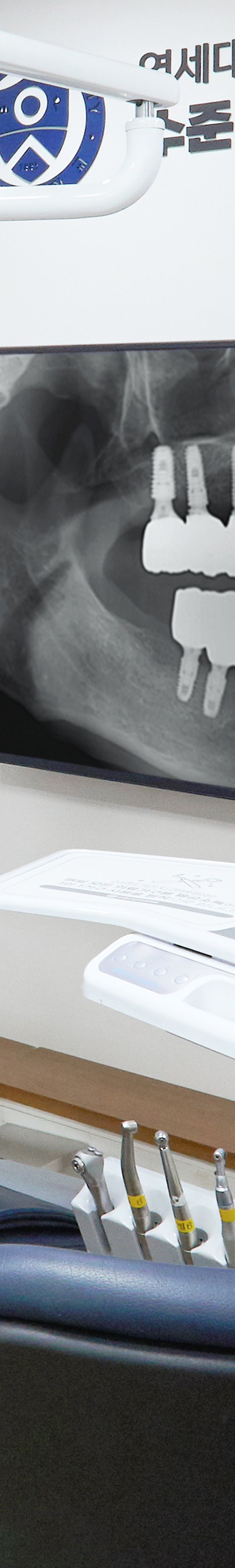 Dangsan Dental Clinic Implant Placement for Long-Term Use image 42