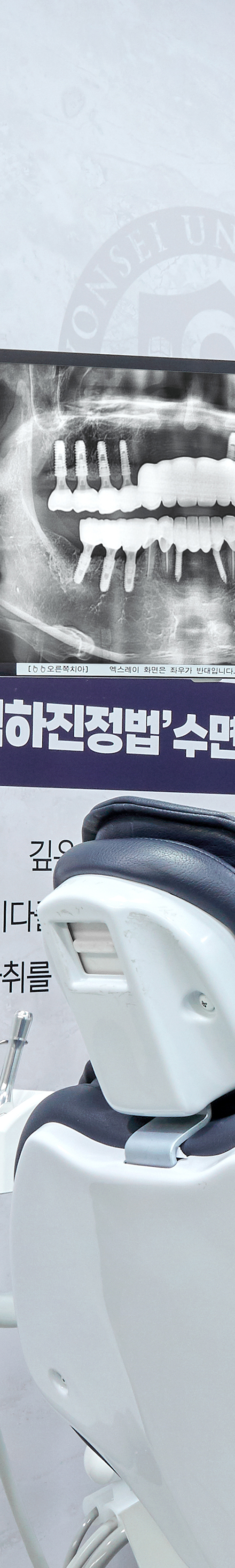 Yangpyeong Station Dental Clinic Implant Care with a Systematic Process image 19