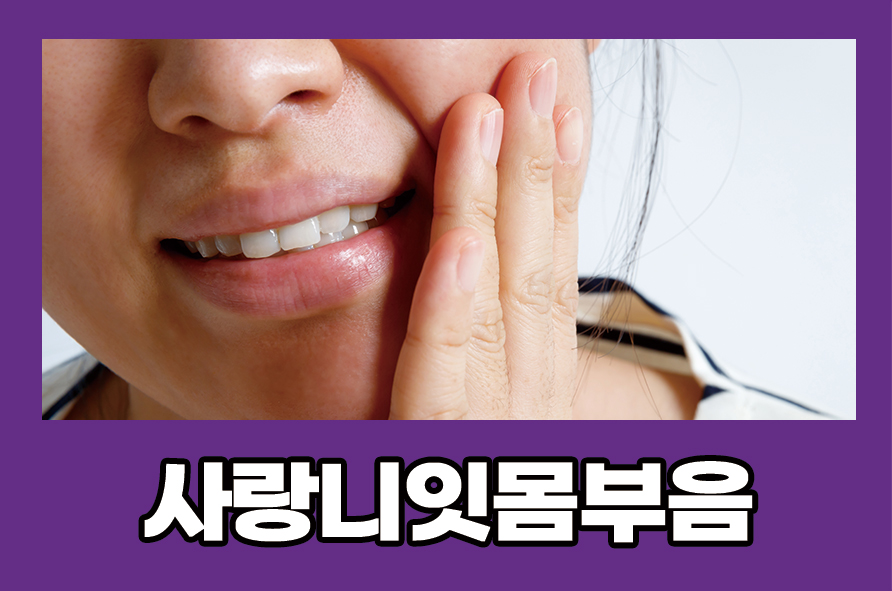 사랑니잇몸부음 매복 발치 후 관리법은 관련 이미지 1
