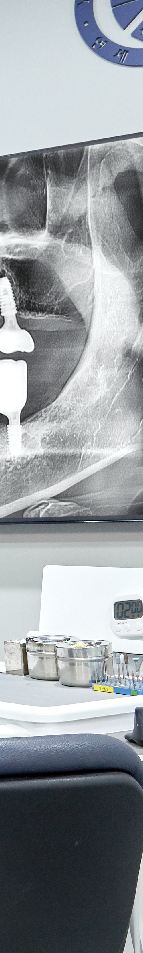 Yeouido Dental Clinic: Implant Treatment Period Depends on the Patient's Condition image 45