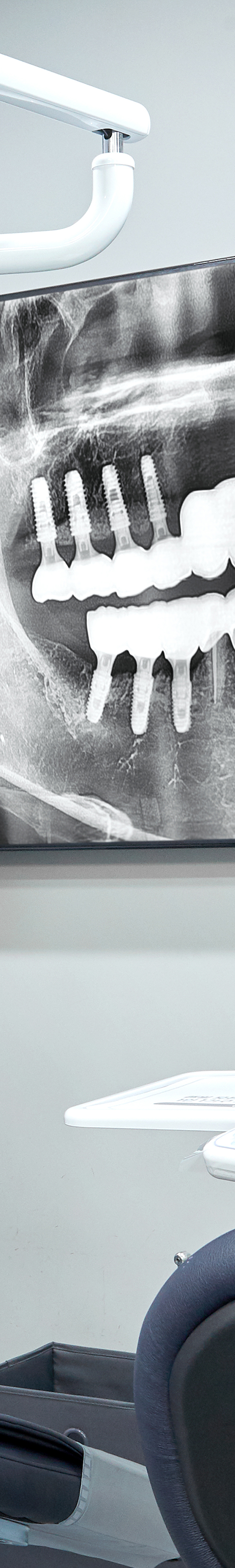 Shinchon Dental Clinic Implant Care Through a Careful Process image 23