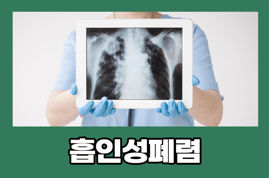 Causes, Symptoms, Treatment, and Prevention of Aspiration Pneumonia image 1