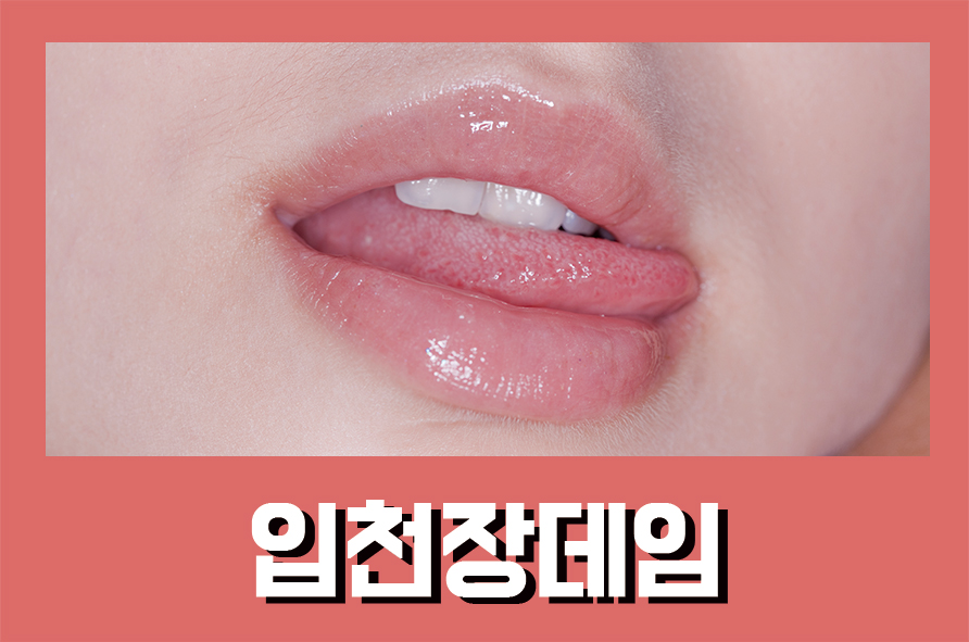 입천장데임 회복하기 위한 세 가지 방법! 관련 이미지 1