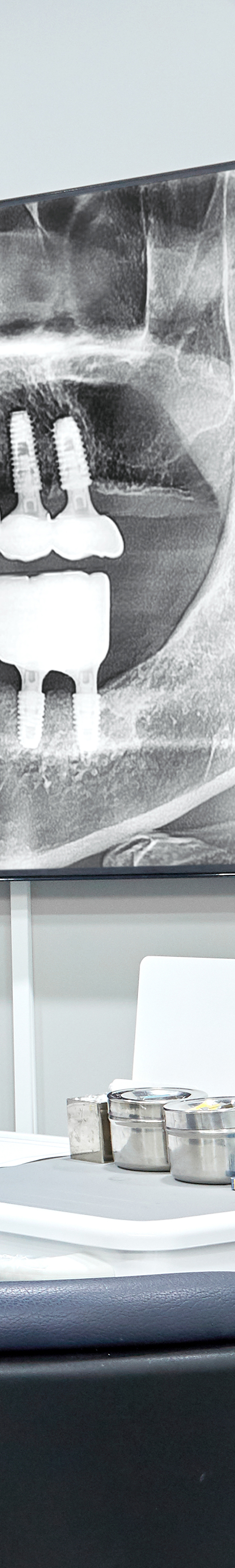 Hapjeong Station Dental Clinic Implant Treatment Through an Appropriate Treatment Plan image 45