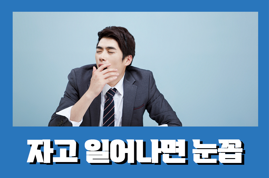 자고일어나면눈꼽 생기는 이유에도 여러가지가 관련 이미지 1