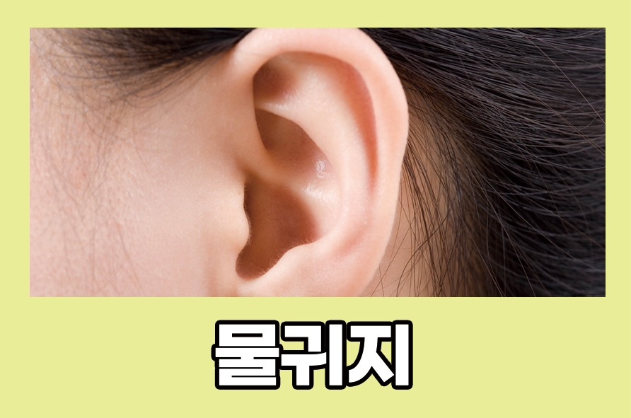 물귀지 마른귀지 차이와 액취증 관련 이미지 1