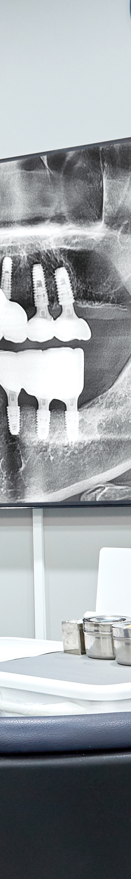 Shinchon Dental Implant Placement and Careful Aftercare image 41