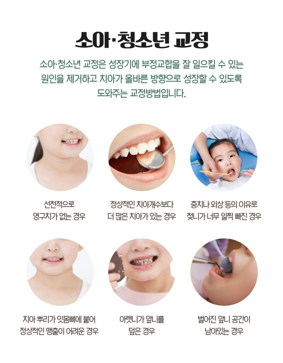 신촌치과 성장기교정 적절한 시기에 시행해야 관련 이미지 2