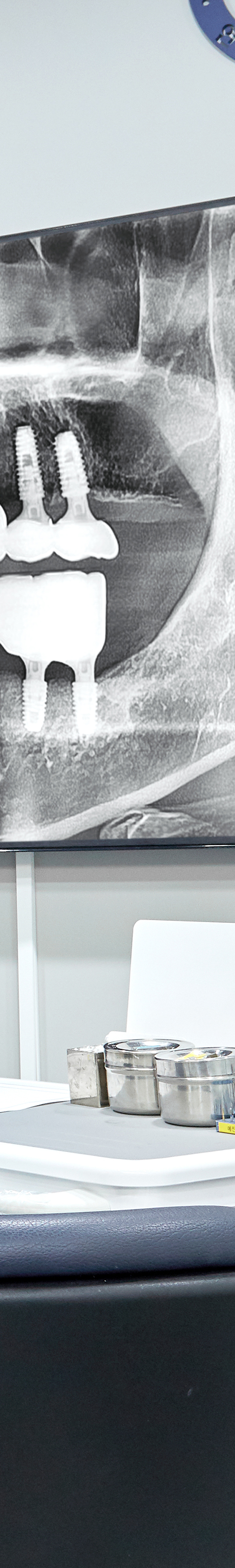 Dangsandong Dental Clinic Implant Care Through a Careful Process image 31