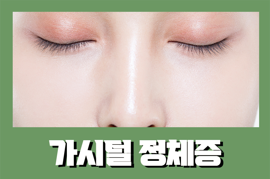 가시털정체증 소극성속모증 블렉헤드라 생각했다면 관련 이미지 1