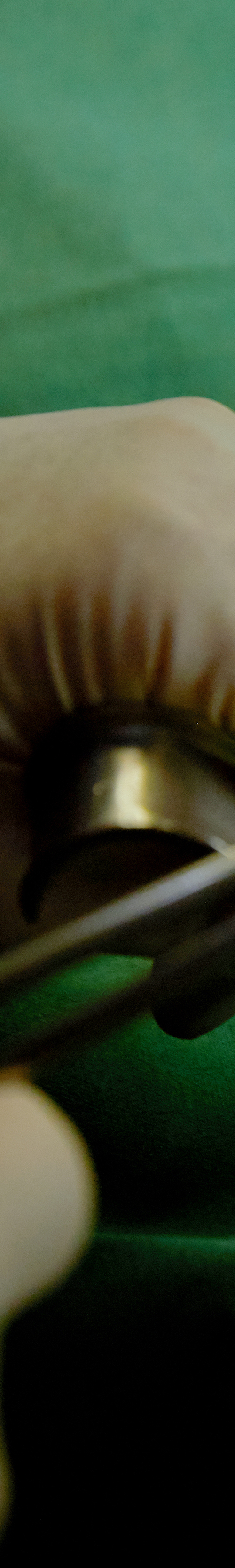 Dangsan Station Dental Clinic Sleep Implant Using Conscious Sedation image 18