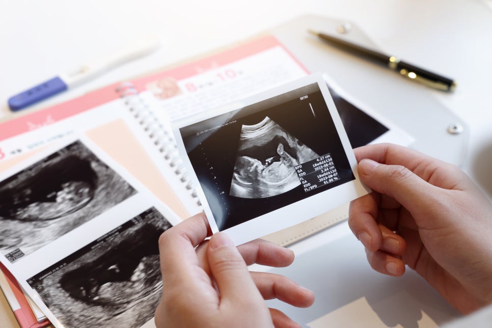 Let’s Learn About Paternity Testing Methods and Costs image 3