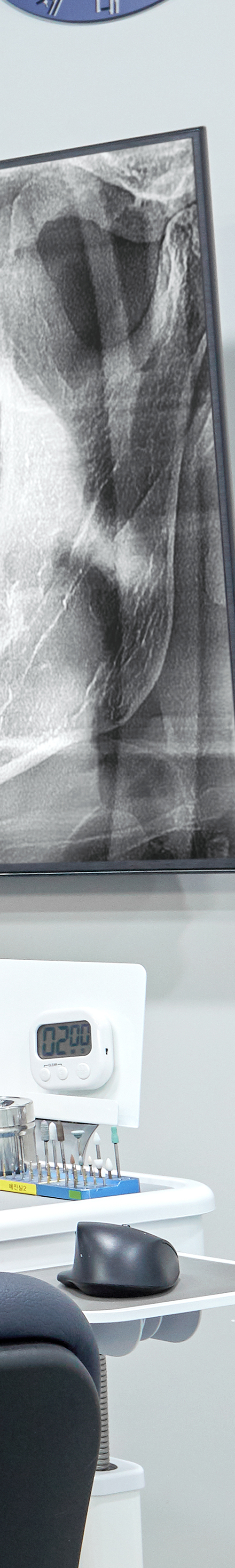 Hapjeong Station Dental Clinic Implant Treatment Through an Appropriate Treatment Plan image 46