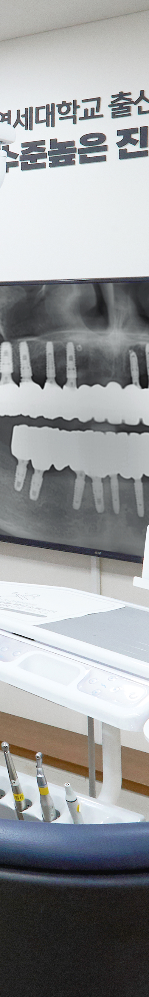Daesang-dong Dental Clinic Implant Placement: Treatment Through a Careful Process image 40