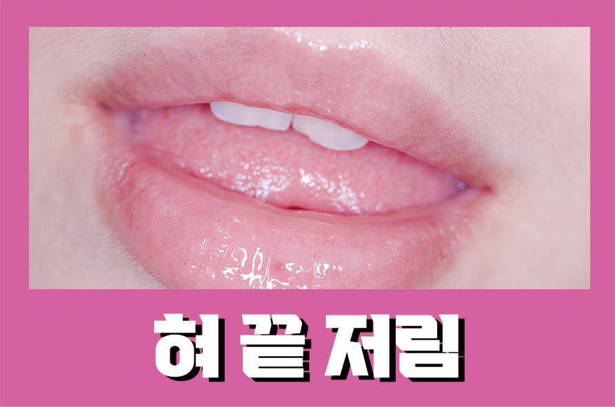 혀끝저림 5가지 원인으로 진단해보자 관련 이미지 1