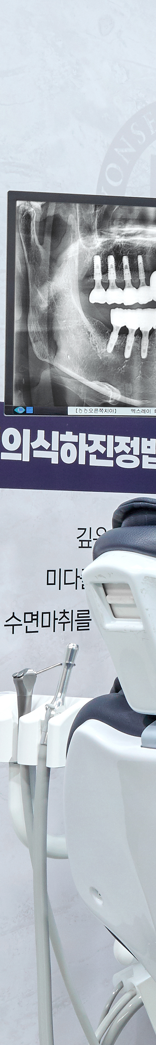 영등포구청역치과 임플란트관리 보다 꼼꼼하게 관련 이미지 18