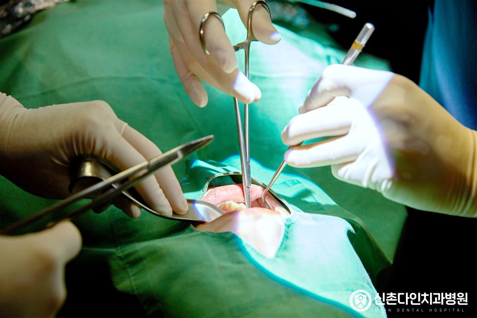 Moonrae Dental Clinic Sleep Implants When You’re Afraid of Dental Treatment image 8