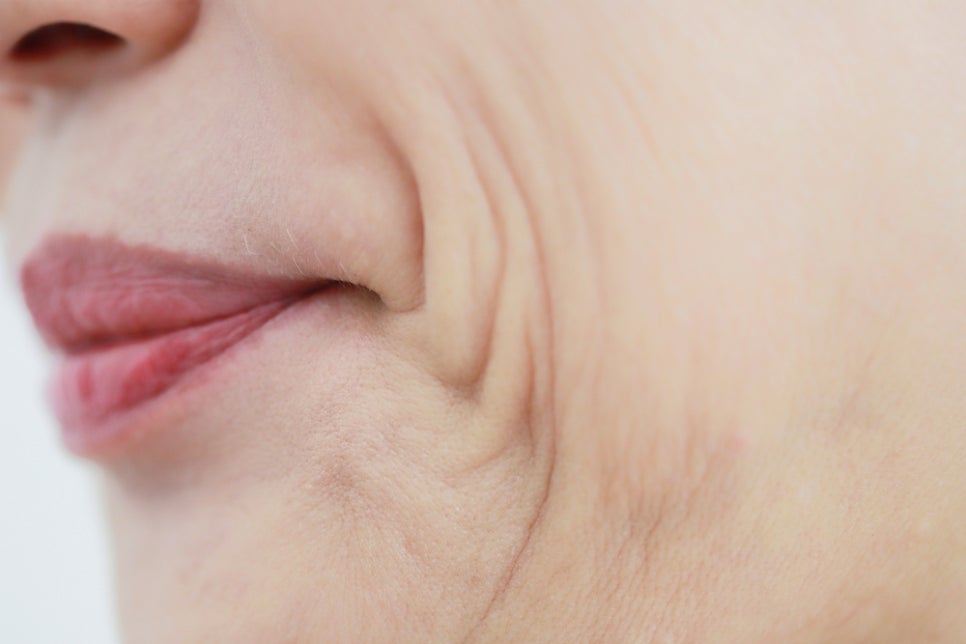 입주변뾰루지 발생위치에 따라 대처가 달라져요 관련 이미지 6
