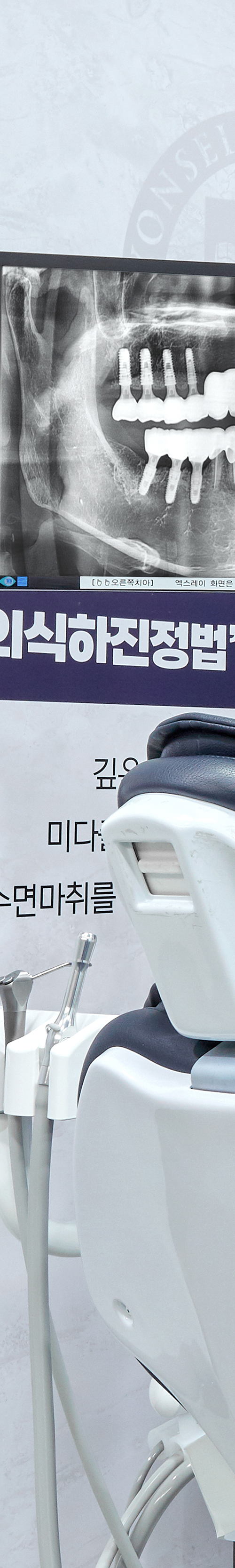 Hongdae Entrance Station Dental Clinic: If You Feel Afraid of Conscious Sedation image 18
