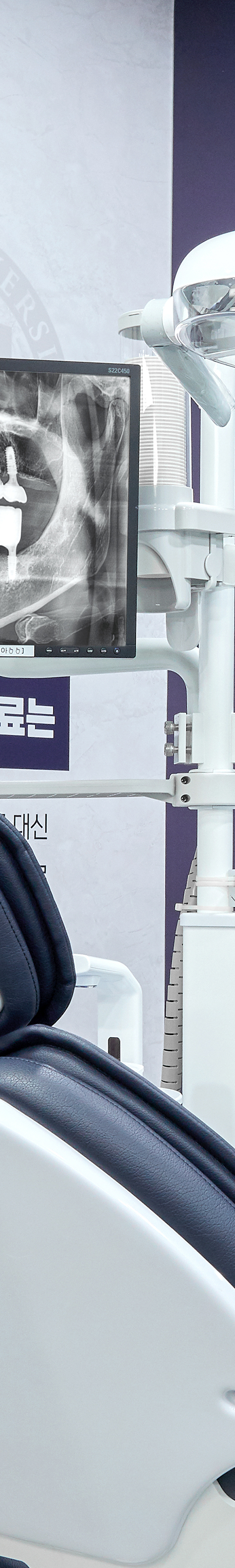 Yeouido Dental Clinic: Implant Treatment Period Depends on the Patient's Condition image 20