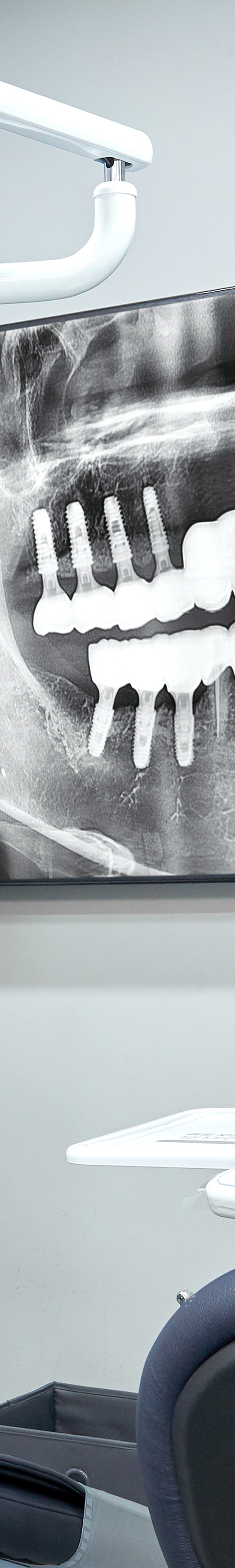 Yeouido Dental Clinic Implant Structure Similar to Natural Teeth image 43