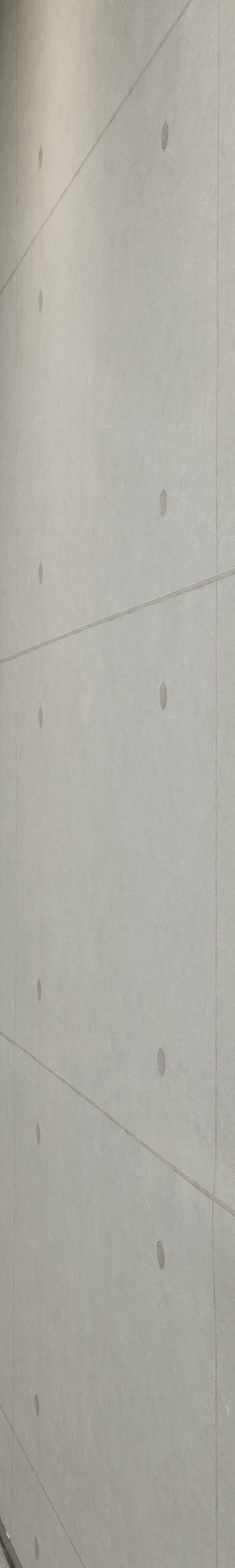 Yeongdeungpo Station Dental Clinic Implant Placement Treatment Made Comfortable image 26