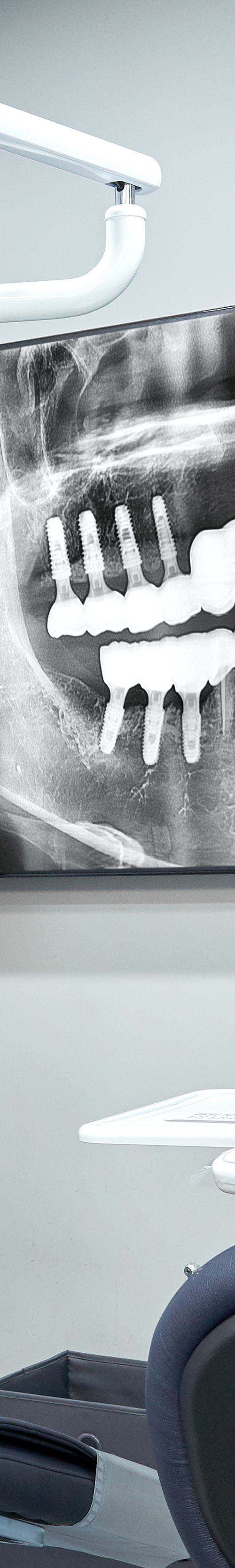 Dangsan Dental Clinic Implant Treatment in a Comfortable State image 39