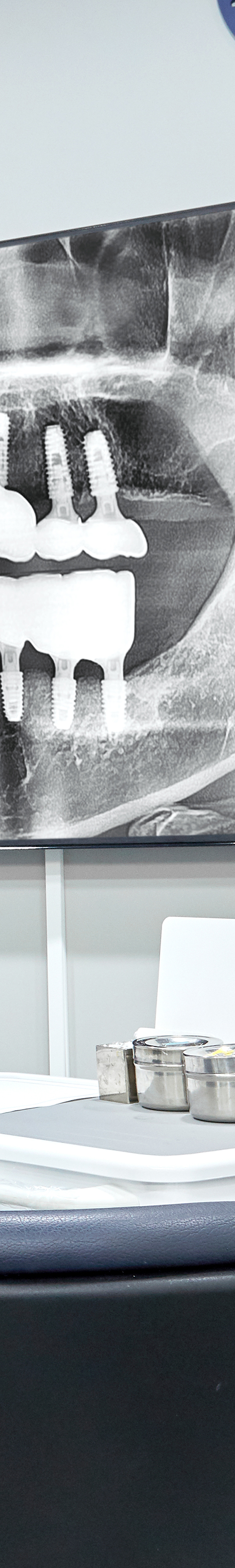 Dangsan Station Dental Clinic Sleep Implant Using Conscious Sedation image 31