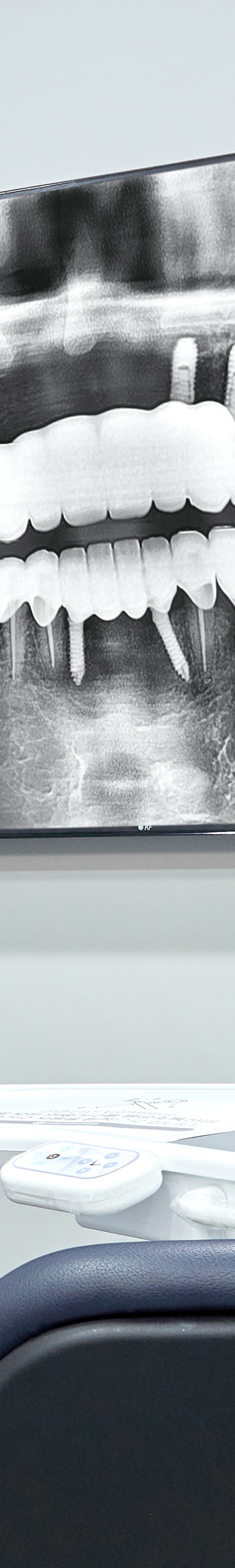 Mangwon-dong Dental Clinic: Comfortable Implant Procedures Through Conscious Sedation image 30