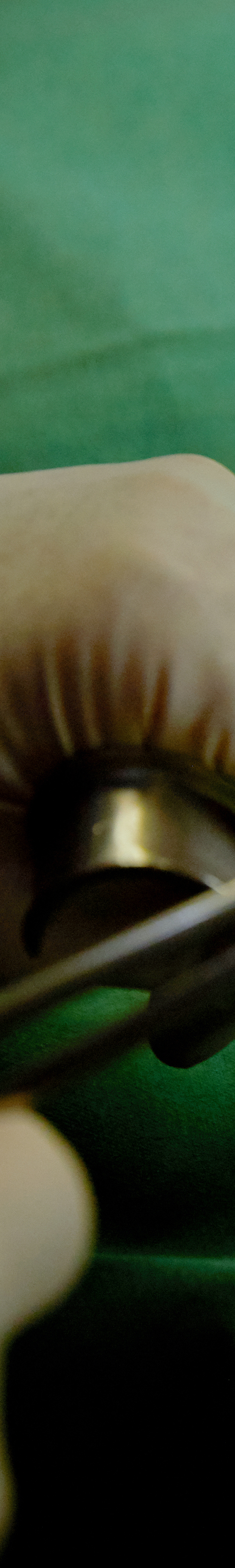 Yeouido Station Dental Clinic - Treatment Through a Precise Implant Placement Process image 24