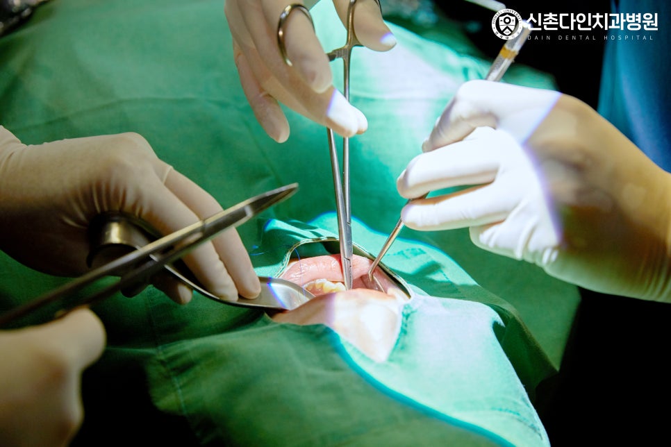 Daesang-dong Dental Clinic Implant Placement: Treatment Through a Careful Process image 10