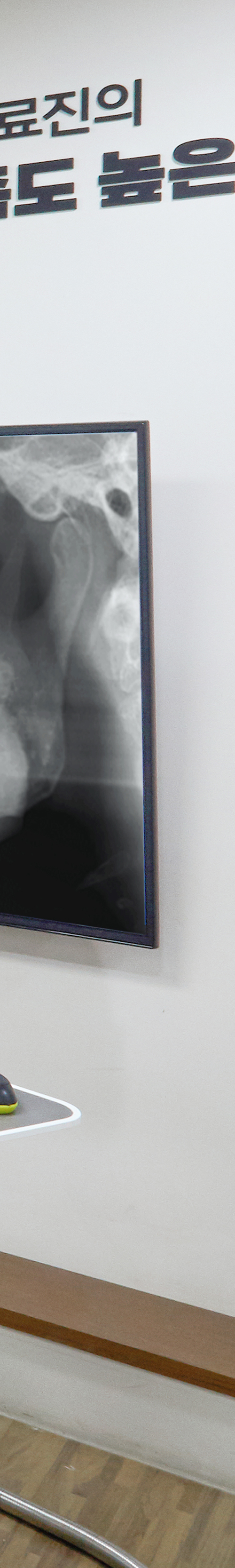 Daesang-dong Dental Clinic Implant Placement: Treatment Through a Careful Process image 42
